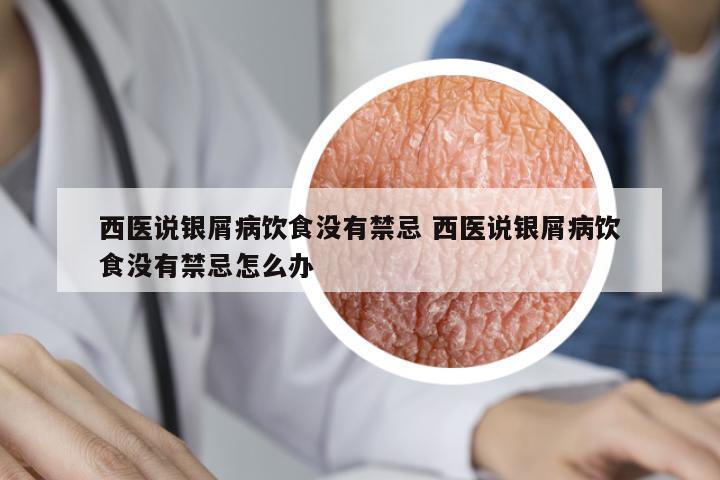 西醫(yī)說銀屑病飲食沒有禁忌 西醫(yī)說銀屑病飲食沒有禁忌怎么辦