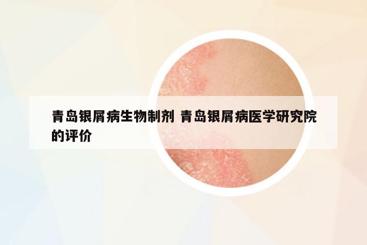 青島銀屑病生物制劑 青島銀屑病醫(yī)學(xué)研究院的評(píng)價(jià)
