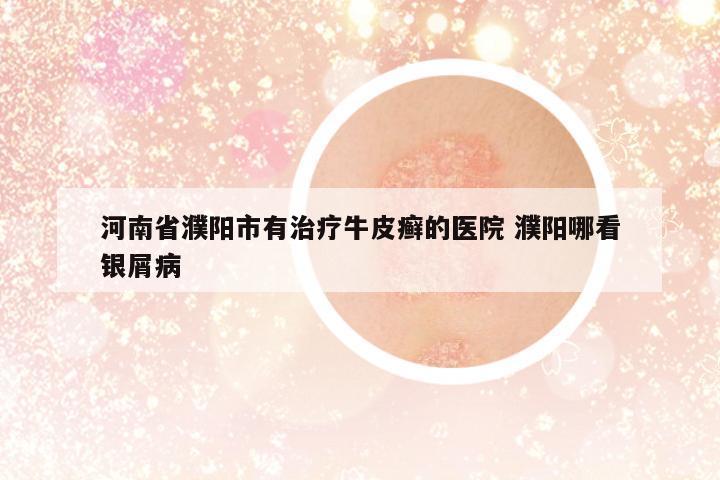 河南省濮陽市有治療牛皮癬的醫(yī)院 濮陽哪看銀屑病