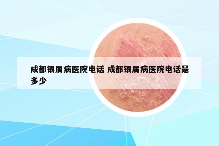 成都銀屑病醫(yī)院電話 成都銀屑病醫(yī)院電話是多少