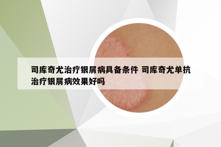 司庫奇尤治療銀屑病具備條件 司庫奇尤單抗治療銀屑病效果好嗎