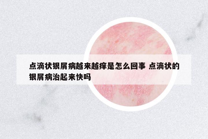 點(diǎn)滴狀銀屑病越來越癢是怎么回事 點(diǎn)滴狀的銀屑病治起來快嗎