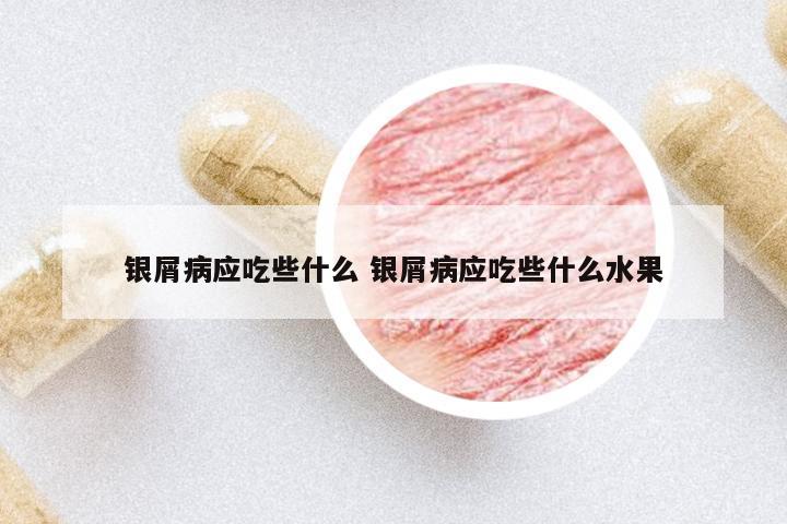 銀屑病應吃些什么 銀屑病應吃些什么水果