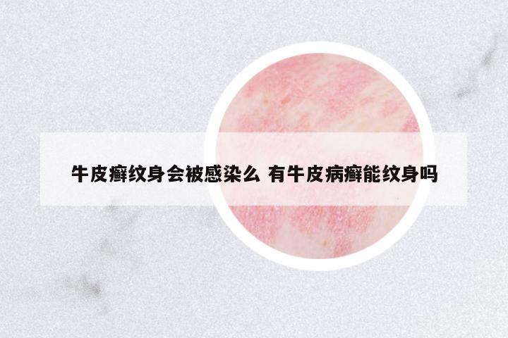 牛皮癬紋身會被感染么 有牛皮病癬能紋身嗎