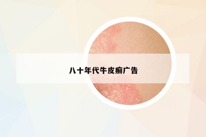 八十年代牛皮癬廣告