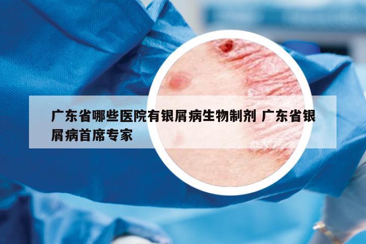 廣東省哪些醫(yī)院有銀屑病生物制劑 廣東省銀屑病首席專家