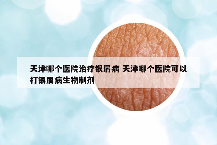 天津哪個醫(yī)院治療銀屑病 天津哪個醫(yī)院可以打銀屑病生物制劑