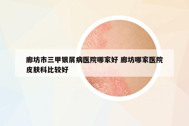 廊坊市三甲銀屑病醫(yī)院哪家好 廊坊哪家醫(yī)院皮膚科比較好
