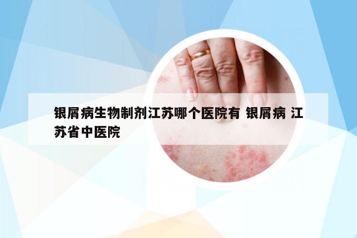 銀屑病生物制劑江蘇哪個(gè)醫(yī)院有 銀屑病 江蘇省中醫(yī)院