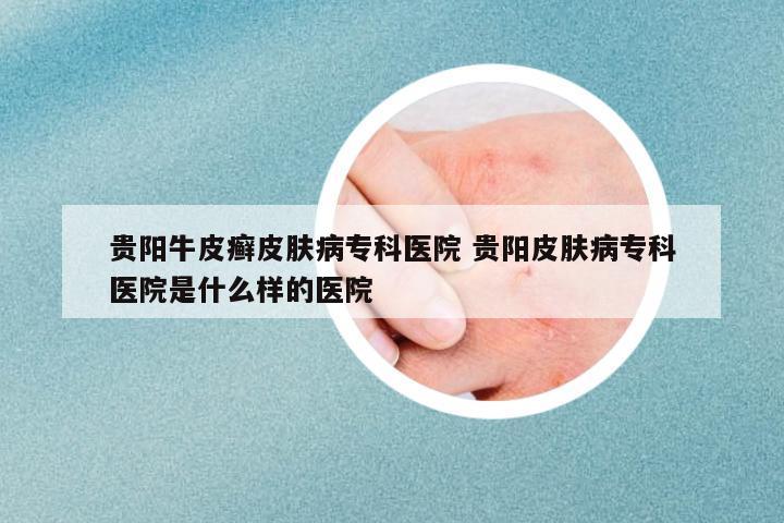 貴陽(yáng)牛皮癬皮膚病專(zhuān)科醫(yī)院 貴陽(yáng)皮膚病專(zhuān)科醫(yī)院是什么樣的醫(yī)院