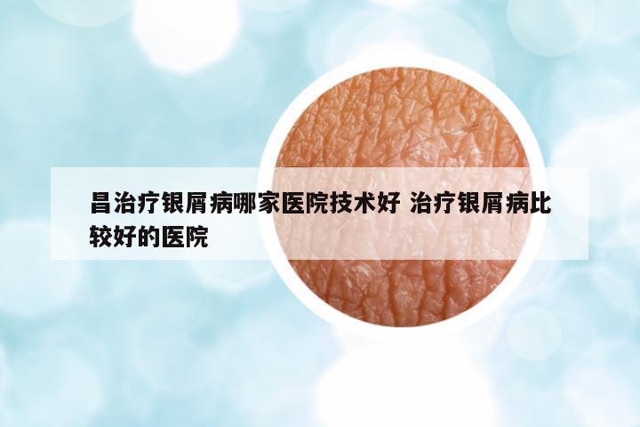 昌治療銀屑病哪家醫(yī)院技術好 治療銀屑病比較好的醫(yī)院