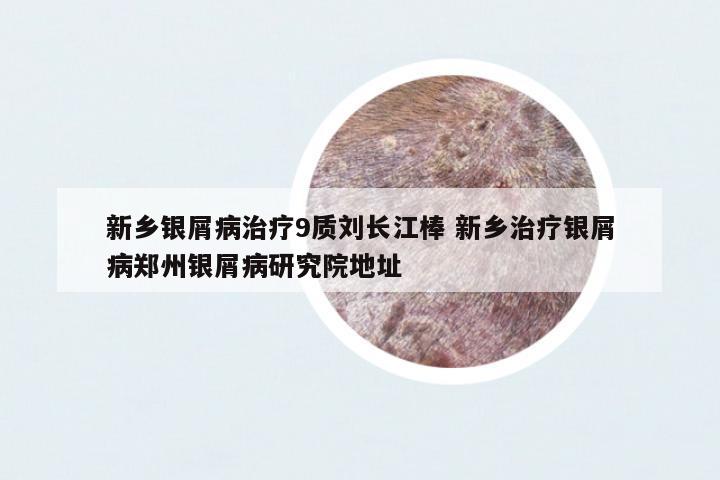 新鄉(xiāng)銀屑病治療9質(zhì)劉長江棒 新鄉(xiāng)治療銀屑病鄭州銀屑病研究院地址