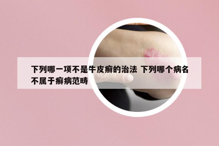 下列哪一項(xiàng)不是牛皮癬的治法 下列哪個(gè)病名不屬于癬病范疇