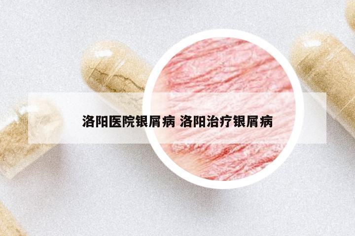 洛陽醫(yī)院銀屑病 洛陽治療銀屑病