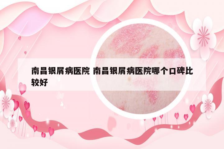 南昌銀屑病醫(yī)院 南昌銀屑病醫(yī)院哪個(gè)口碑比較好