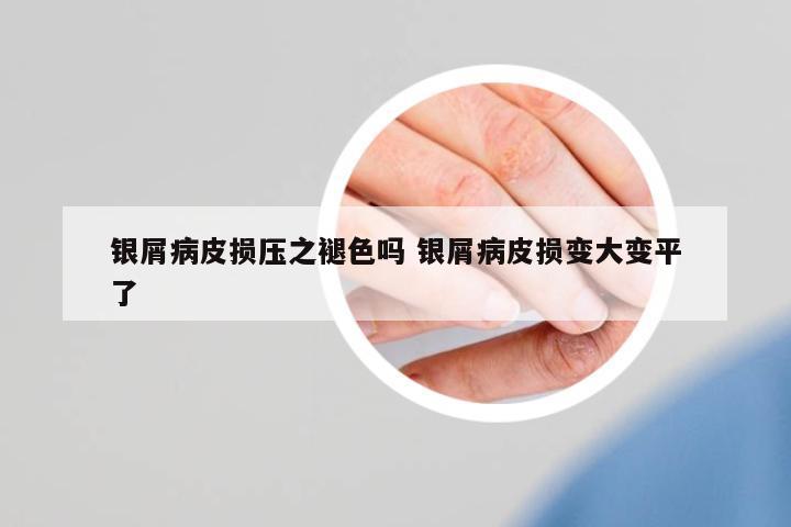 銀屑病皮損壓之褪色嗎 銀屑病皮損變大變平了