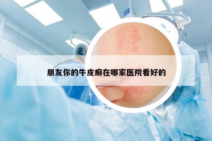 朋友你的牛皮癬在哪家醫(yī)院看好的