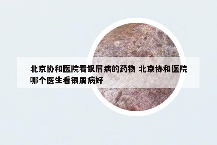 北京協(xié)和醫(yī)院看銀屑病的藥物 北京協(xié)和醫(yī)院哪個醫(yī)生看銀屑病好