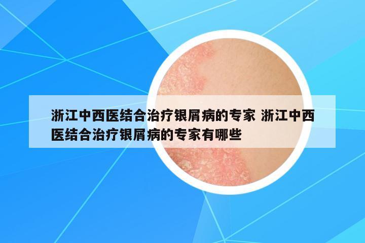 浙江中西醫(yī)結(jié)合治療銀屑病的專家 浙江中西醫(yī)結(jié)合治療銀屑病的專家有哪些