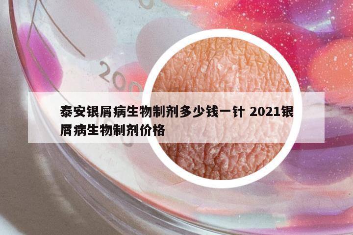 泰安銀屑病生物制劑多少錢一針 2021銀屑病生物制劑價格