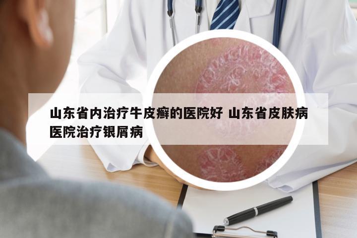 山東省內(nèi)治療牛皮癬的醫(yī)院好 山東省皮膚病醫(yī)院治療銀屑病