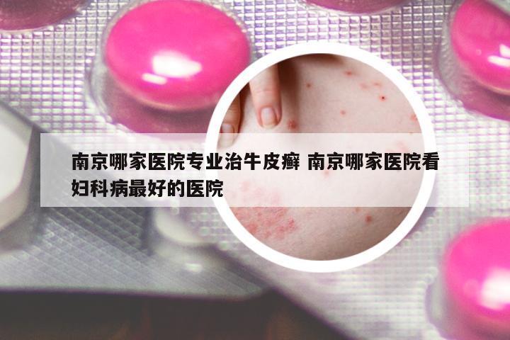 南京哪家醫(yī)院專業(yè)治牛皮癬 南京哪家醫(yī)院看婦科病最好的醫(yī)院