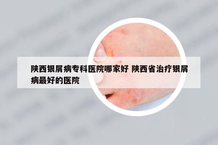 陜西銀屑病??漆t(yī)院哪家好 陜西省治療銀屑病最好的醫(yī)院