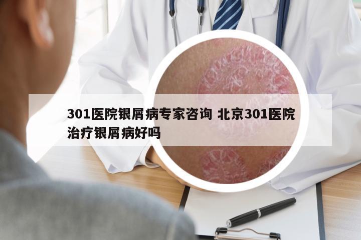301醫(yī)院銀屑病專(zhuān)家咨詢 北京301醫(yī)院治療銀屑病好嗎