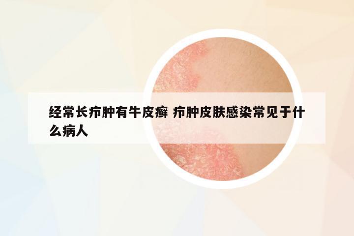 經(jīng)常長癤腫有牛皮癬 癤腫皮膚感染常見于什么病人