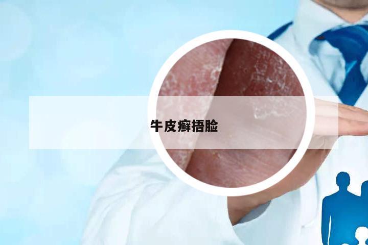 牛皮癬捂臉
