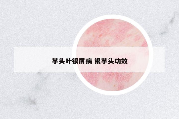 芋頭葉銀屑病 銀芋頭功效