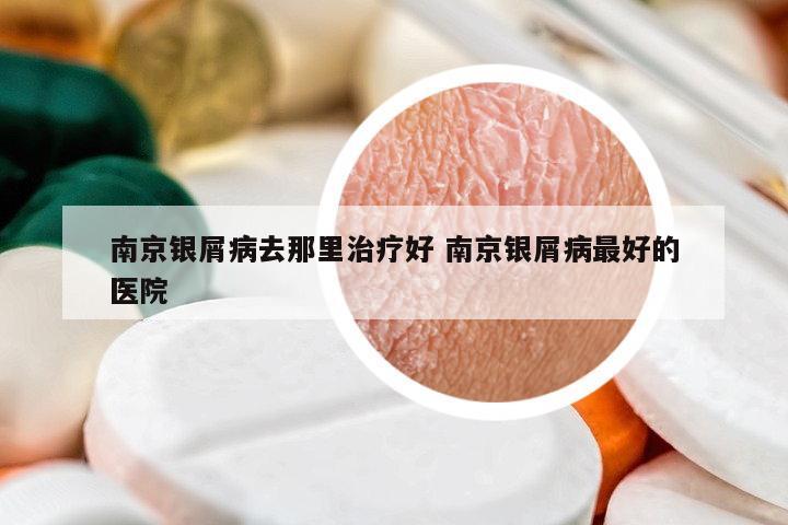 南京銀屑病去那里治療好 南京銀屑病最好的醫(yī)院