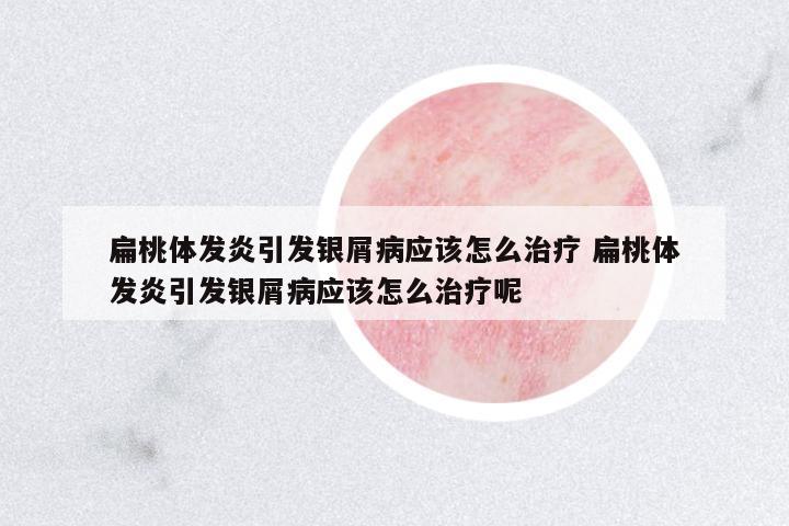 扁桃體發(fā)炎引發(fā)銀屑病應(yīng)該怎么治療 扁桃體發(fā)炎引發(fā)銀屑病應(yīng)該怎么治療呢