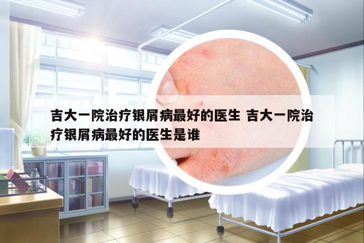 吉大一院治療銀屑病最好的醫(yī)生 吉大一院治療銀屑病最好的醫(yī)生是誰