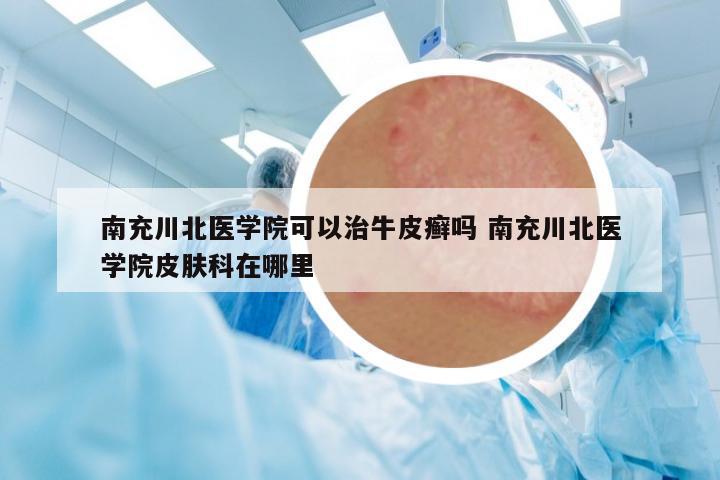 南充川北醫(yī)學院可以治牛皮癬嗎 南充川北醫(yī)學院皮膚科在哪里