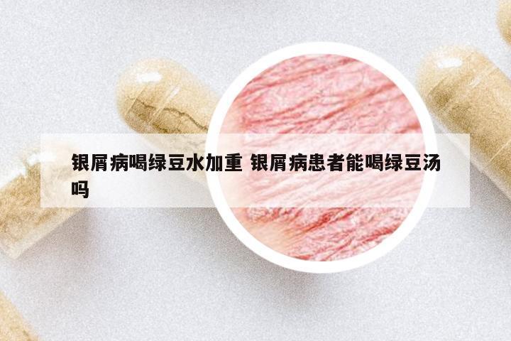銀屑病喝綠豆水加重 銀屑病患者能喝綠豆湯嗎