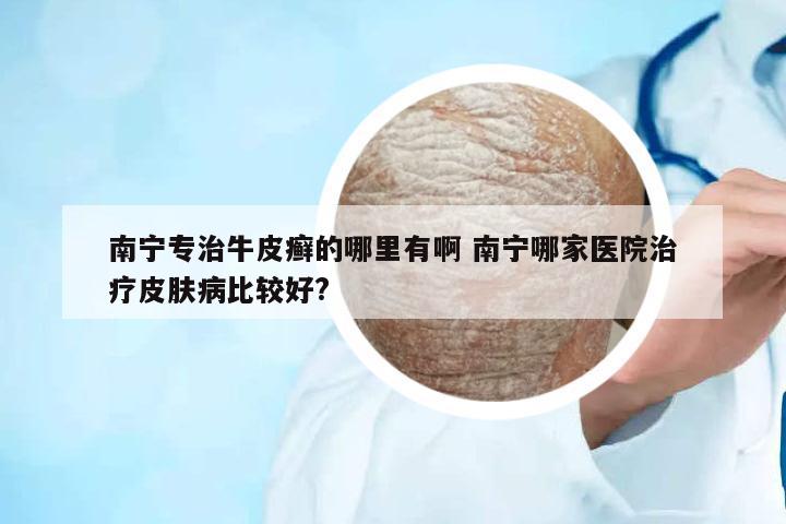 南寧專治牛皮癬的哪里有啊 南寧哪家醫(yī)院治療皮膚病比較好?