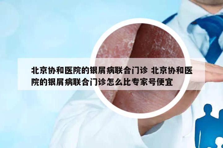 北京協(xié)和醫(yī)院的銀屑病聯(lián)合門診 北京協(xié)和醫(yī)院的銀屑病聯(lián)合門診怎么比專家號便宜