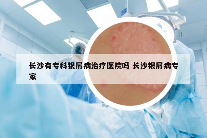 長沙有專科銀屑病治療醫(yī)院嗎 長沙銀屑病專家