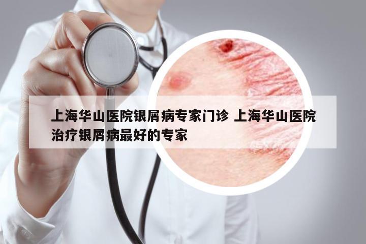 上海華山醫(yī)院銀屑病專家門診 上海華山醫(yī)院治療銀屑病最好的專家