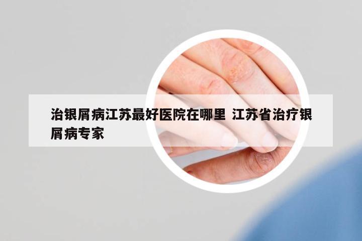 治銀屑病江蘇最好醫(yī)院在哪里 江蘇省治療銀屑病專(zhuān)家