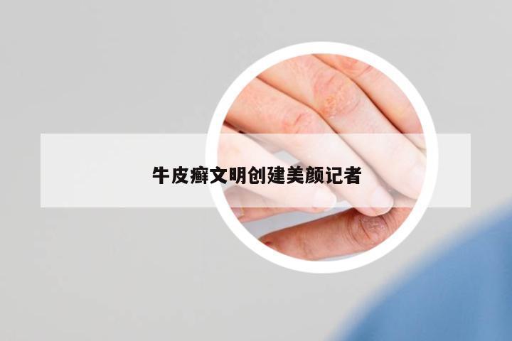 牛皮癬文明創(chuàng)建美顏記者