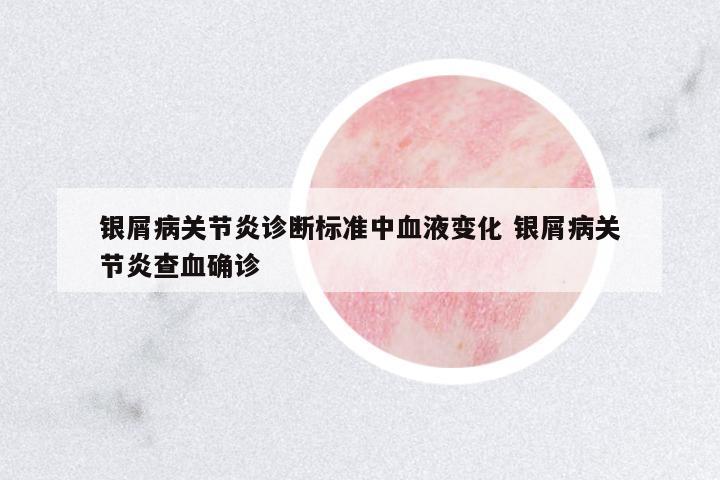 銀屑病關(guān)節(jié)炎診斷標(biāo)準(zhǔn)中血液變化 銀屑病關(guān)節(jié)炎查血確診