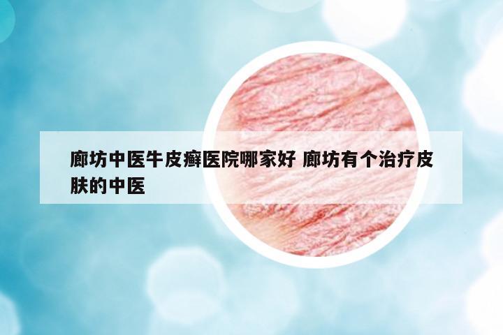 廊坊中醫(yī)牛皮癬醫(yī)院哪家好 廊坊有個治療皮膚的中醫(yī)