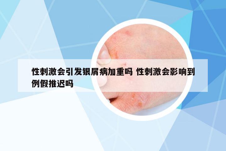 性刺激會(huì)引發(fā)銀屑病加重嗎 性刺激會(huì)影響到例假推遲嗎