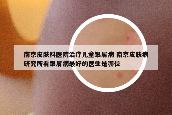 南京皮膚科醫(yī)院治療兒童銀屑病 南京皮膚病研究所看銀屑病最好的醫(yī)生是哪位