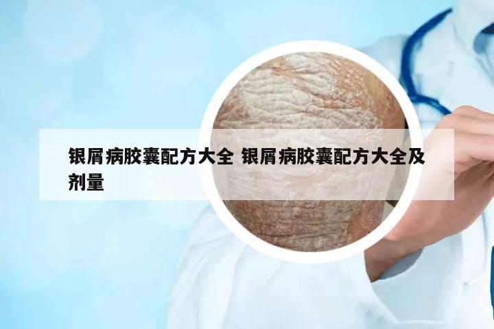 銀屑病膠囊配方大全 銀屑病膠囊配方大全及劑量
