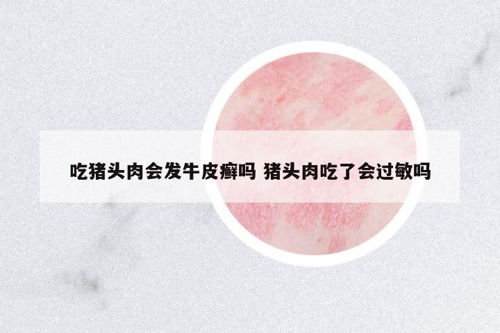 吃豬頭肉會發(fā)牛皮癬嗎 豬頭肉吃了會過敏嗎