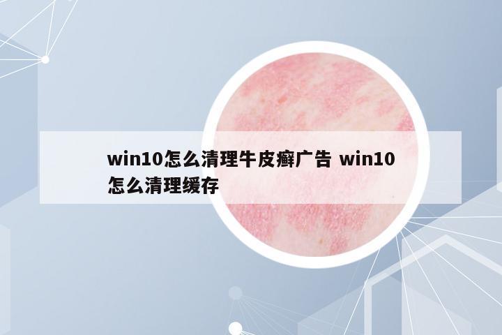 win10怎么清理牛皮癬廣告 win10怎么清理緩存