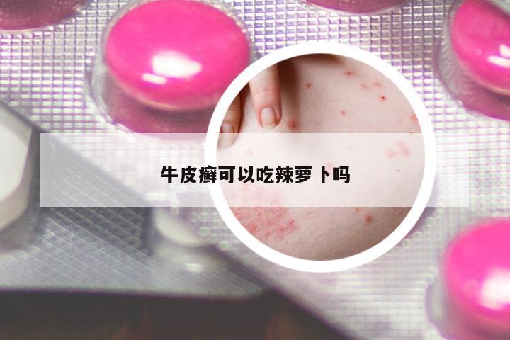 牛皮癬可以吃辣蘿卜嗎